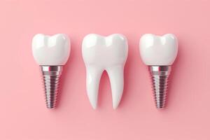 White dental tooth implants on pink background photo