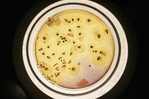 Close, up focused ,,view of Trichoderma in the rounded lab container photo