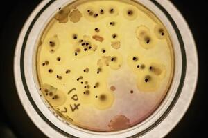 Close up focused, view ,of Trichoderma in the rounded lab container photo