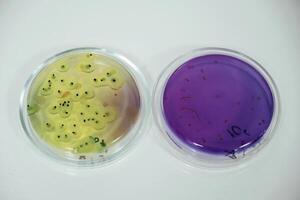 Close up focused view of Trichoderma in the rounded lab containers photo