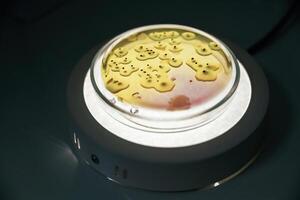Close up, focused view of Trichoderma in the rounded lab container photo
