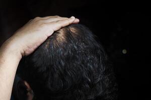 Man touching his balding scalp in a dimly lit setting photo
