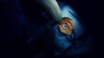 Eye surgery. Eye-specialist operating patient's eye. Operation on eye in operating room. Surgical procedure to improve vision. Close-up. video