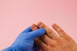 Medical professional examines fingernails for health signs photo