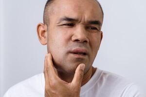 A man has facial swelling due to an allergic reaction to triggers such as insect bites stings photo