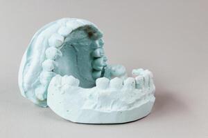 Dental Plaster Model of Teeth and Gums photo