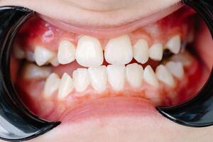 Patient suffering from toothache waiting for dentist in clinic photo