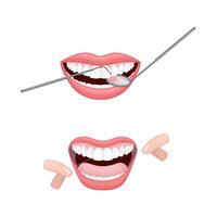 Open Mouth with Dental Tools and Floss Set vector