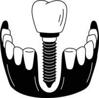 Doodle style illustration of tooth implant vector