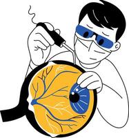 A sketchy illustration showing eye surgery procedure vector