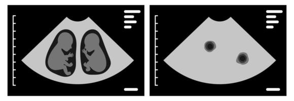 Ultrasound scan showing dichorionic diamniotic twins during pregnancy vector