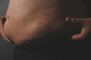 A man's stomach with a large amount of fat photo