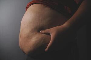 A man with a large belly photo