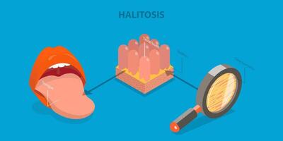 3D Isometric Flat Illustration of Halitosis, Bacterial Causes of Bad Breath vector