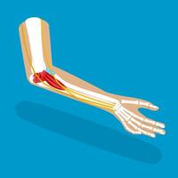 3D Isometric Flat Illustration of Ulnar Collateral Ligament, UCL Structure vector