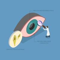 3D Isometric Flat Illustration of Demodex Folliculorum, Demodicosis Affecting the Eyelid and Causing Red Eyes vector