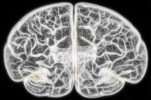 An intricate visual of the human brain shows delicate neural pathways illuminated against a dark background. This artistic interpretation emphasizes connectivity and complexity in brain function. photo