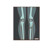 Cartoon groovy xray scan showing human leg bones, vector