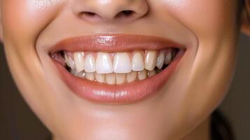 A beautiful smile with perfect white teeth and shiny, healthy lips in close-up. photo