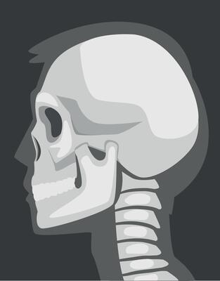 X-ray Film of Side Viewed Skull Illustrated Image for Educational Purpose