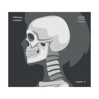 Roentgenograph of Skull Side View Image vector