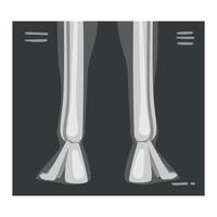 Roentgenograph of Lower Leg Back View Image vector