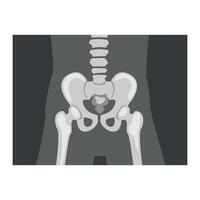 Roentgenograph of Coxofemoral Joint Front View Image vector