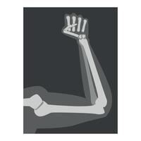 Roentgenograph of Forearm Front View Image vector
