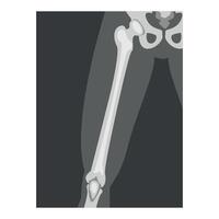 Roentgenograph of Upper Leg Front View Image vector