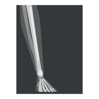 Roentgenograph of Lower Leg Front View Image vector