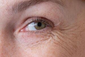 Cropped eye with wrinkles of middle aged caucasian woman smiling and looking at camera showing crow's feet photo