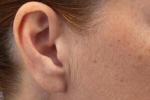 Close up of preauricular wrinkles in front of ears on woman face photo