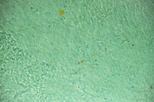 Fallen leaves floating on the surface of outdoor swimming pool water. High quality photo. photo