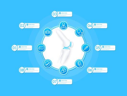 Knee joint bone health care infographic with presentation timeline steps medical research. And stethoscope, syringe, saline, drug, ambulance car, doctor. Style icons on blue background.