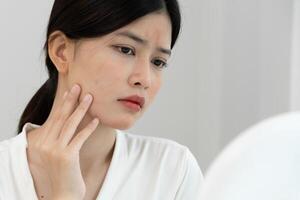 worried about face Dermatology, rosacea dermatitis, allergic steroids, sensitive skin, red face from sunburn, acne, dry skin, large pores ,rash face, dull, freckles, wrinkle photo