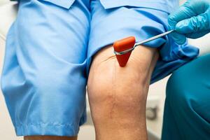 doctor knock on knee reflex nerve for check and treatment senior photo