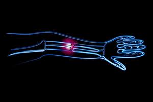 A closed forearm fracture. Outline drawing of a hand fracture. X-ray of the hand. vector