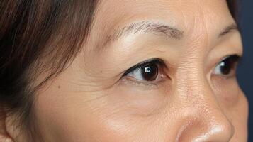 Close-up view of a person's face, focusing on the eyes and wrinkles. photo