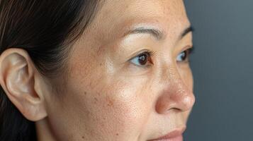 A woman with freckles on her face photo