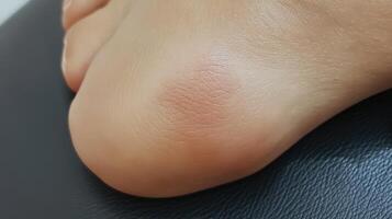 Close-up view of a reddish discoloration on a heel. photo