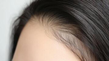 Close-up view of a person's hairline and dark hair. photo