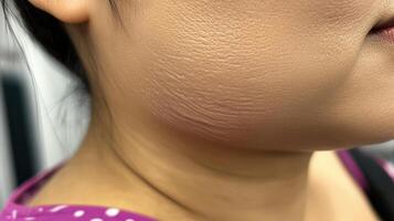 Close-up view of a person's neck and jawline skin texture. photo