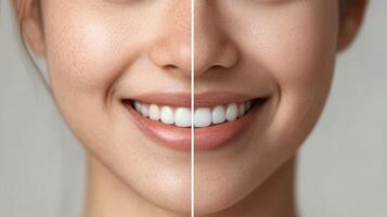 Comparison of teeth whitening treatment results. photo