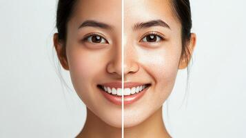 Before and after facial skin comparison image. photo