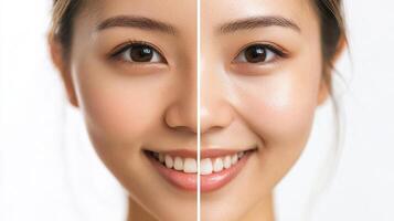 Comparison of facial skin tones before and after treatment. photo
