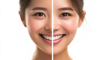 A woman with a white smile before and after photo