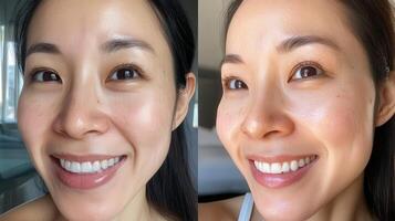 Comparison of skin tones before and after light application. photo