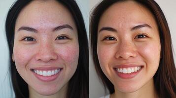 Before and after skin improvement comparison image. photo