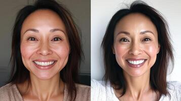 Before and after facial beauty image comparison. photo