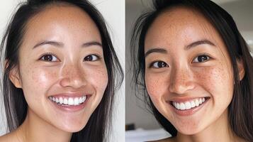 Two photos of a woman with freckles on her face